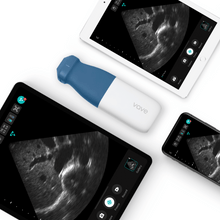 Load image into Gallery viewer, Vave Phased-Array Wireless Ultrasound - Spring Promo
